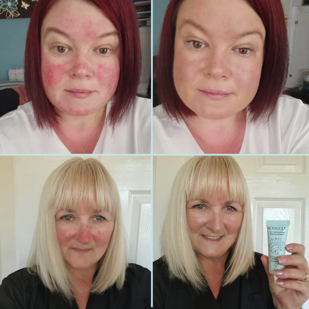 Rosalique 3-in-1 Anti-Redness Miracle Formula SPF50 Moisturiser 30ml