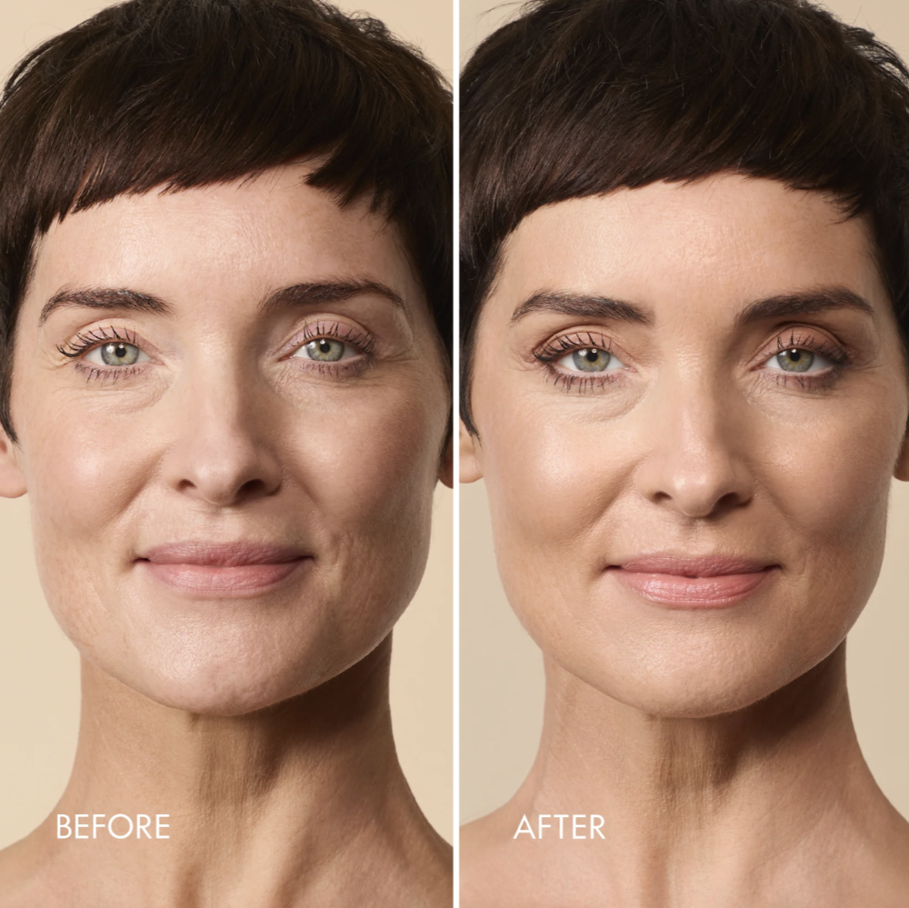 Before-and-after split comparison of a woman's face showing skincare or makeup results, with 'BEFORE' on the left and 'AFTER' on the right, against a warm beige background.