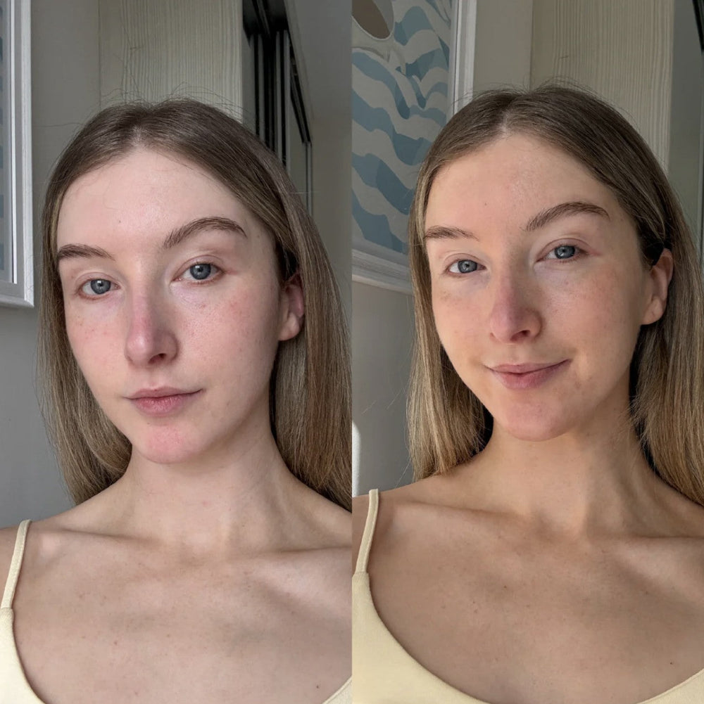 A side-by-side before and after comparison overnight tan mask. The left side shows freckles and natural skin tone, while the right side shows a smoother, more even complexion.
