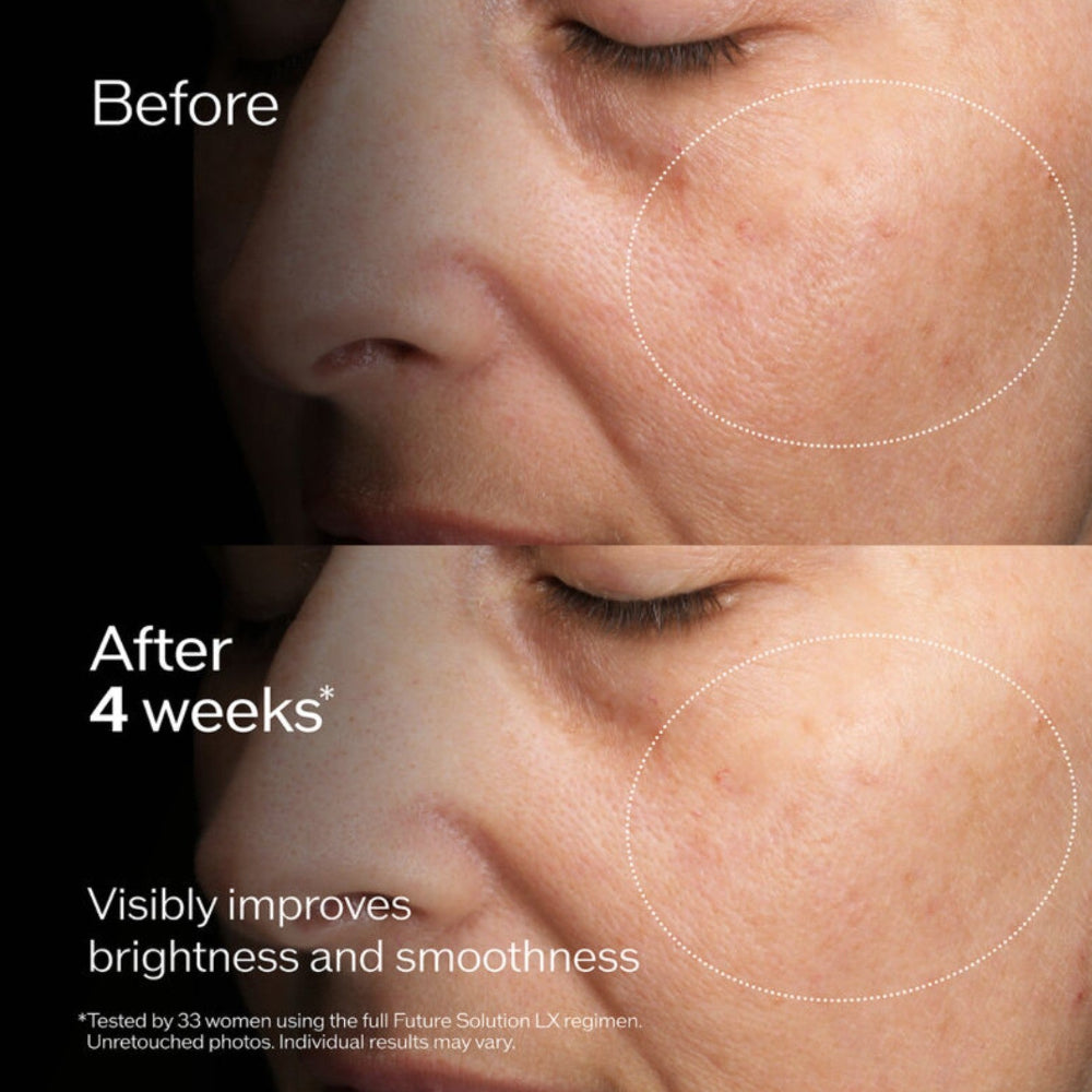 Before and after comparison of skin improvement with text indicating a 4-week duration.