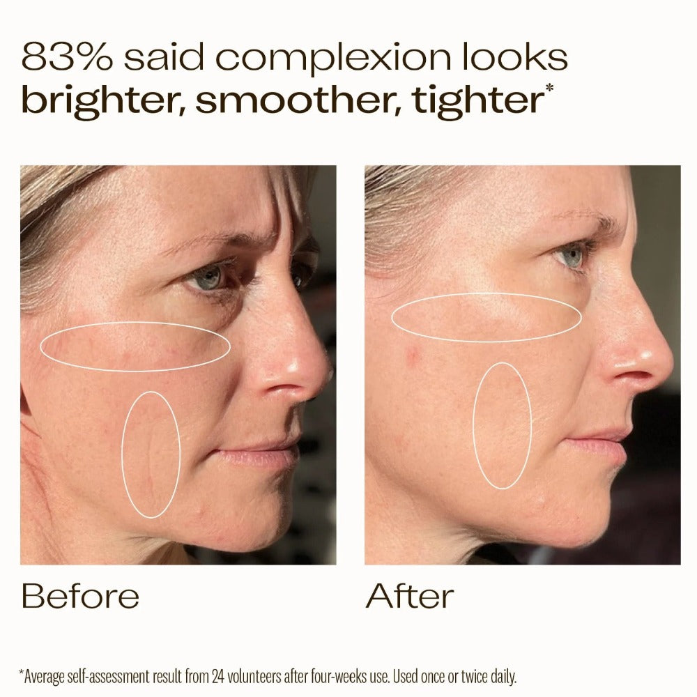 Trilogy Vitamin C+ Super Serum 30ml