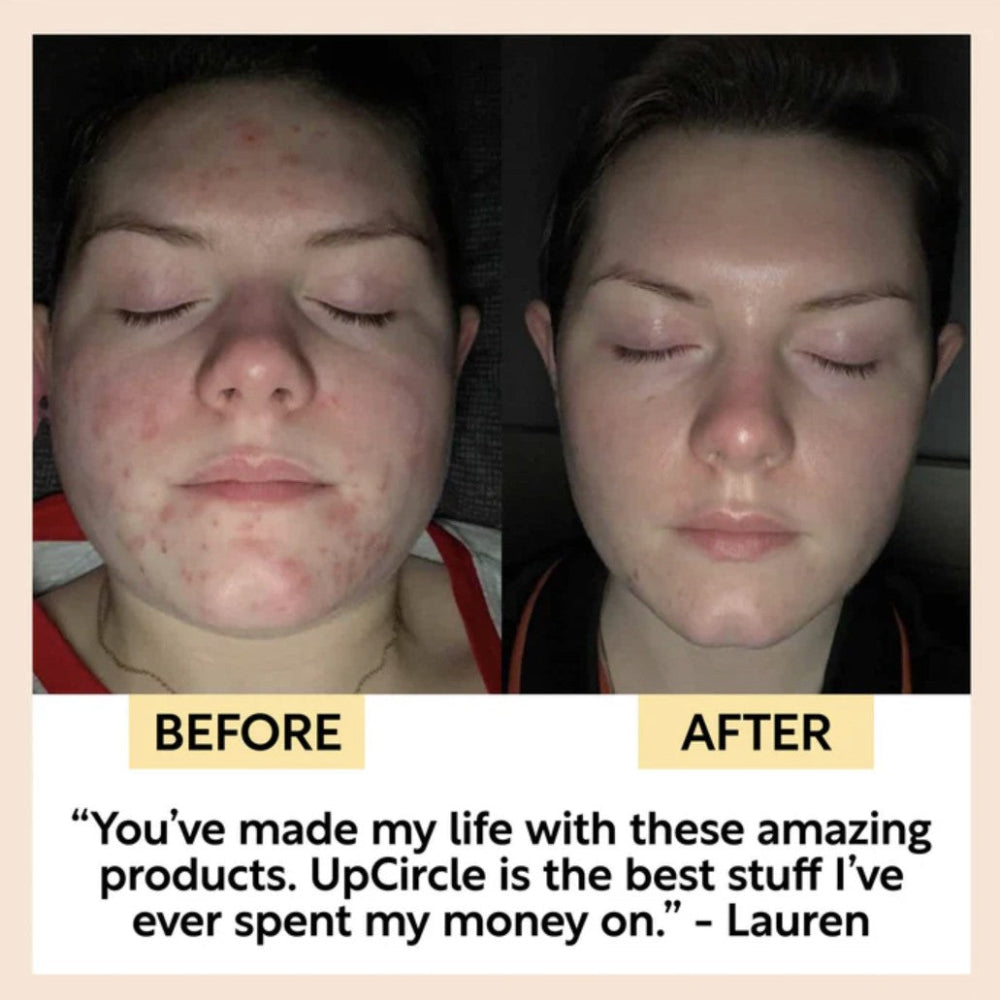 UpCircle Skincare - Gentle Cleansing Face Milk with Oat Powder + Aloe Vera 120ml model before and after of using products