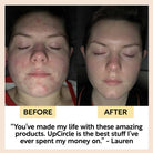 UpCircle Skincare - Gentle Cleansing Face Milk with Oat Powder + Aloe Vera 120ml model before and after of using products