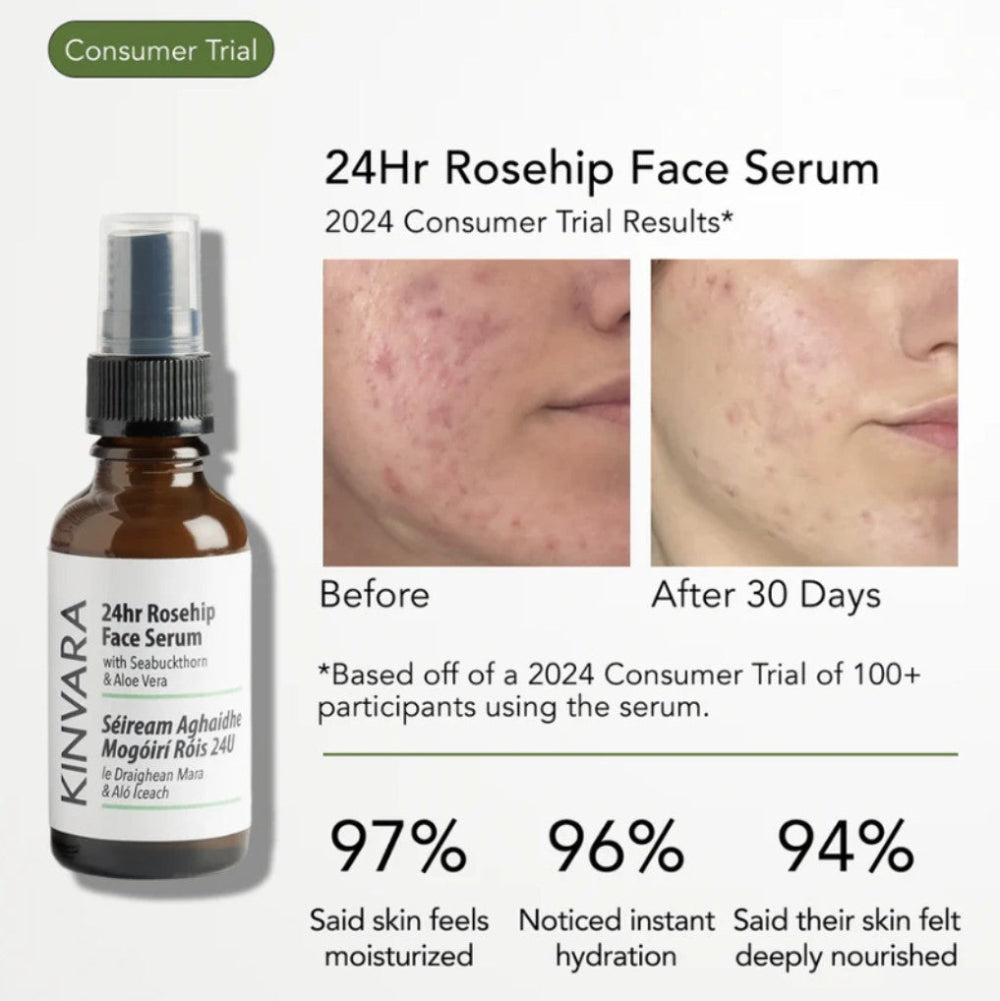 Kinvara 24Hr Rosehip Face Serum 30ml