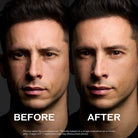 Before and after comparison of a person's face with 'Before' on the left and 'After' on the right.