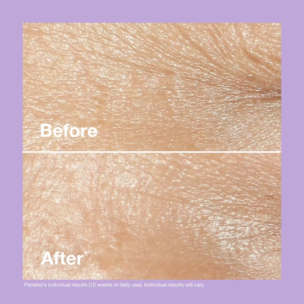 Clinique Smart Clinical Repair Wrinkle Cream 50ml results