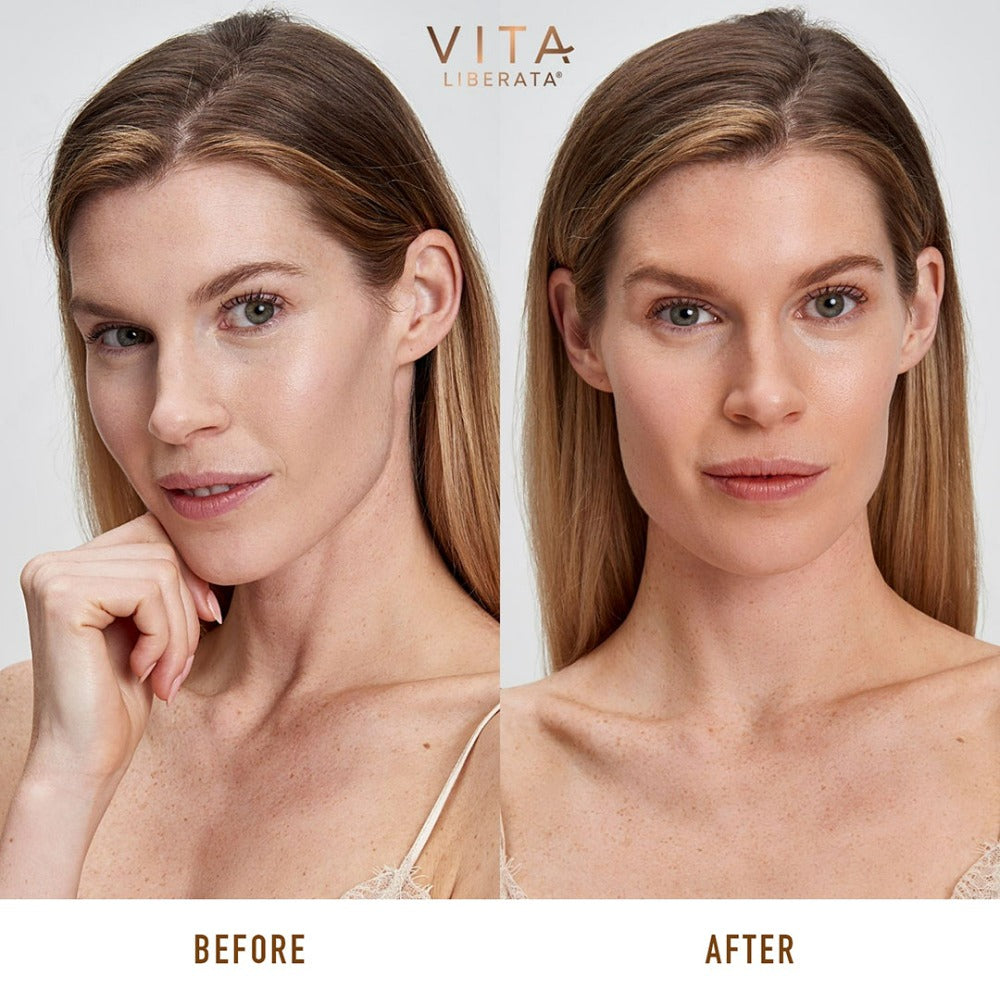 Vita Liberata Anti-Age Face Serum 15ml before and after results on model